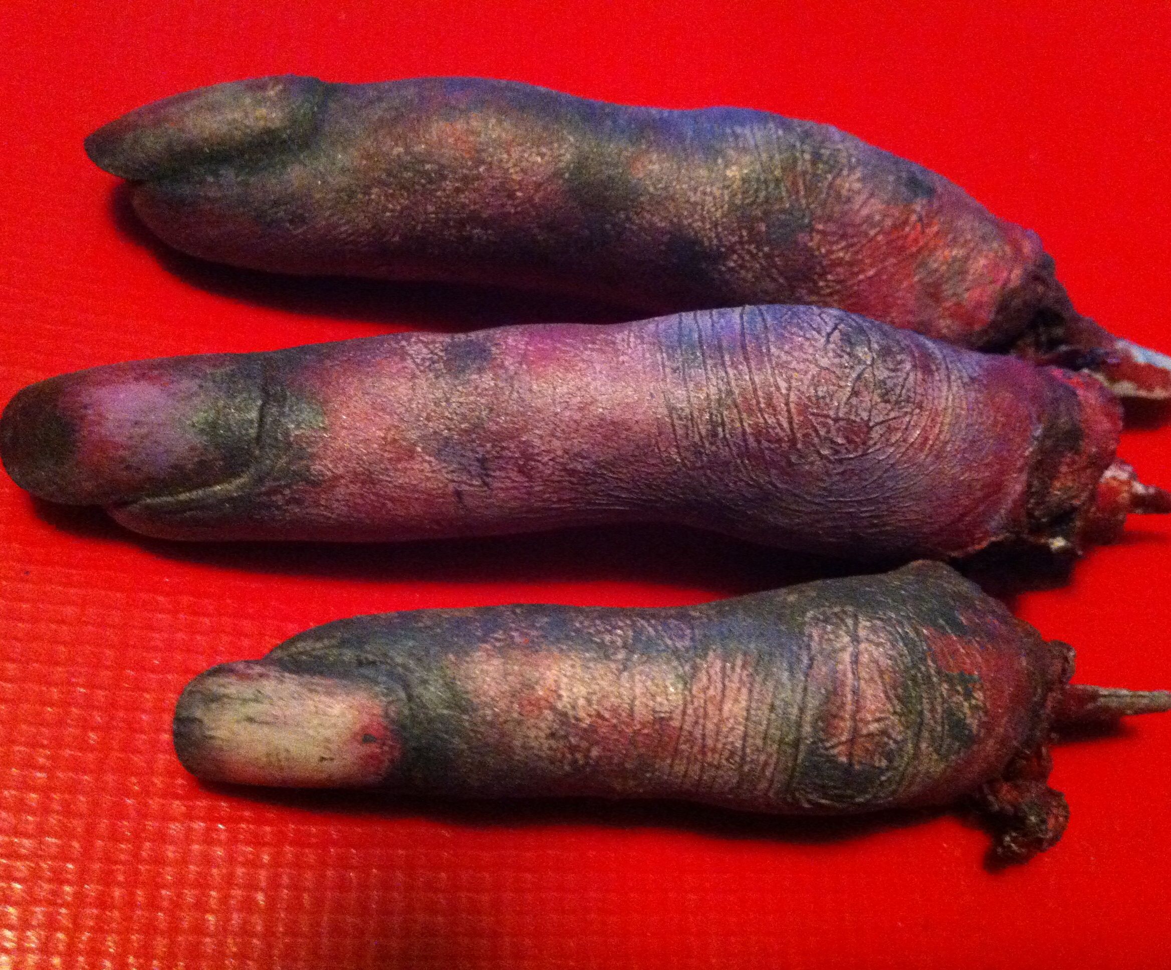 Simple severed fingers