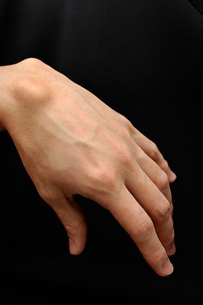 Get rid of a ganglion- painlessly