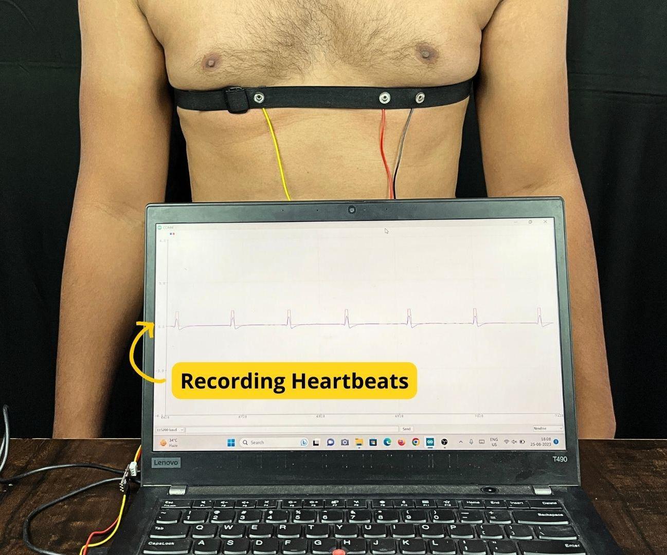 Detecting Heart Beats Using BioAmp EXG Pill